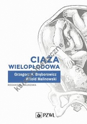 Ciąża wielopłodowa