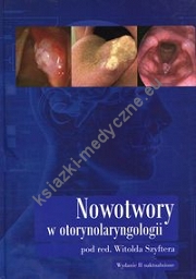 Nowotwory w otorynolaryngologii