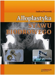 Alloplastyka stawu biodrowego