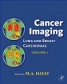 Cancer Imaging vol 1 Lung & Breast Cracinomas