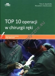 TOP 10 operacji w chirurgii ręki