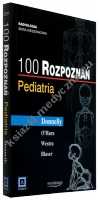 100 rozpoznań. Pediatria