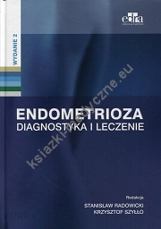 Endometrioza. Diagnostyka i leczenie.