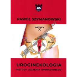 Uroginekologia - metody leczenia operacyjnego