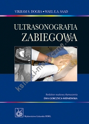 Ultrasonografia zabiegowa