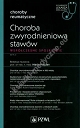 Choroba zwyrodnieniowa stawów