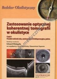 Zastosowanie optycznej koherentnej tomografii w okulistyce Część 1