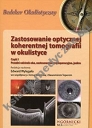 Zastosowanie optycznej koherentnej tomografii w okulistyce Część 1