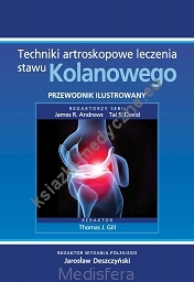 Techniki artroskopowe leczenia stawu kolanowego