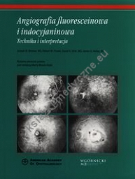 Angiografia fluoresceinowa i indocyjaninowa