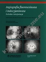 Angiografia fluoresceinowa i indocyjaninowa