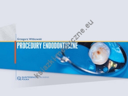 Procedury Endodontyczne