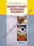 Nowotwory narządu wzroku