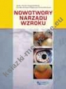 Nowotwory narządu wzroku