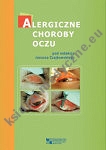 Alergiczne choroby oczu 