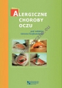 Alergiczne choroby oczu 