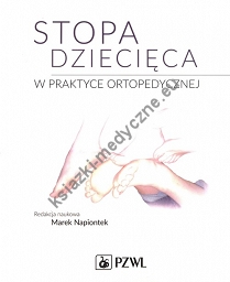 Stopa dziecięca w praktyce ortopedycznej