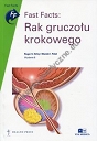 Rak gruczołu krokowego