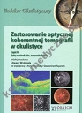 Zastosowanie optycznej koherentnej tomografii w okulistyce Część 2