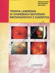 Terapia laserowa w chorobach siatkówki niezwiązanych z cukrzycą