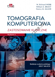 Tomografia komputerowa Zastosowanie kliniczne