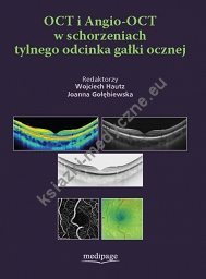 OCT i Angio-OCT w schorzeniach tylnego odcinka gałki ocznej
