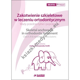 Zakotwienie szkieletowe w leczeniu ortodontycznym. Wady przednio-tylne i poprzeczne