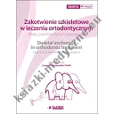 Zakotwienie szkieletowe w leczeniu ortodontycznym. Wady przednio-tylne i poprzeczne