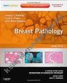 Breast Pathology 2e Expert Consult - Online and Print