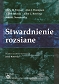 Stwardnienie rozsiane