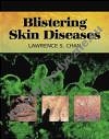 Blistering Skin Diseases
