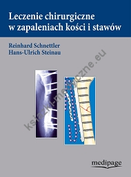 Leczenie chirurgiczne w zapaleniach kości i stawów