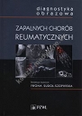 Diagnostyka obrazowa zapalnych chorób reumatycznych