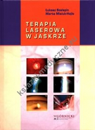 Terapia laserowa w jaskrze