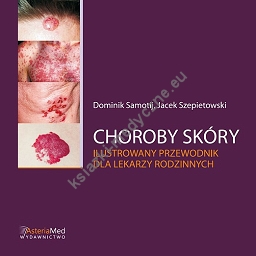 Choroby skóry - ilustrowany przewodnik dla lekarzy rodzinnych