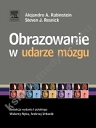 Obrazowanie w udarze mózgu