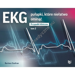 EKG Pułapki, Które Niełatwo Ominąć. Przypadki Kliniczne Tom 2