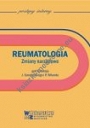 Reumatologia. Zmiany narządowe