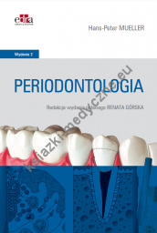 Periodontologia H.P. Mueller Wydanie II