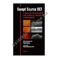 Swept Source OCT