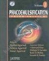 Phacoemulsification 2 vols