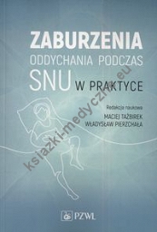 Zaburzenia oddychania podczas snu w praktyce