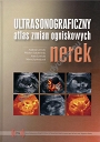 Ultrasonograficzny atlas zmian ogniskowych nerek