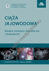 Ciąża jajowodowa aktualne możliwości diagnostyczne i terapeutyczne