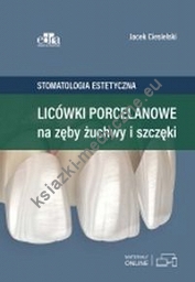 Licówki porcelanowe na zęby żuchwy i szczęki