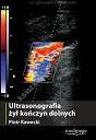 Ultrasonografia żył kończyn dolnych Kawecki