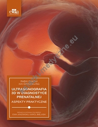 Ultrasonografia 3D w diagnostyce prenatalnej