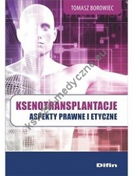 Ksenotransplantacje Aspekty prawne i etyczne