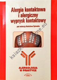 Alergia kontaktowa i alergiczny wyprysk kontaktowy