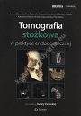 Tomografia stożkowa w praktyce endodontycznej